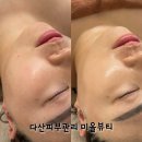 다산피부관리 미올뷰티에서 다산수분폭탄물광 관리 받은 찐후기