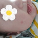 고은소아청소년과의원 네이버블로그