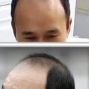 루비셀뷰티랩평화점 네이버블로그