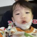 부산_동래수의원, 서면미테크성형외과 23개월아기 턱 찢어짐(같은곳 2번 꿰맨이야기1)