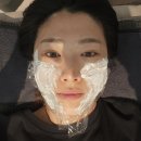 일지한의원 | 매선 매선요법 얼굴비대칭 웨딩준비 입꼬리비대칭 교정 2,3회차 후기 / 치료 교정 한의원