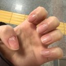 땡쓰네일 - 시흥시 | [내돈내산 눈밑지 일기 02] "눈밑지 일주일 차"라고 쓰고, "금주 일주일 차"라고 읽는다..🍻❌ | 수술...