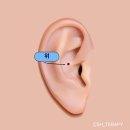 손 혈자리 서금요법 | 소화불량에 도움이 되는 이혈테라피 혈자리