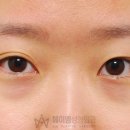 에이엠성형외과의원 네이버블로그