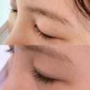 라인속눈썹 | 속눈썹길어지는방법 인천 설레인라인 속눈썹생장술 받은 후기