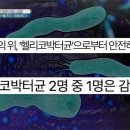 위통