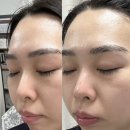 두정초등학교 | 천안에스테틱 오마주 21 스킨케어 맞춤관리후기