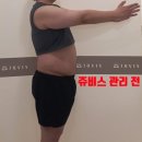 고도독 | 망포역 헬스장 마운자로 18kg 남자 단기간 고도비만 감량 리얼 후기