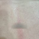 어썸바디 | 김포피부관리 어썸에스테틱 바디관리 E-슬림해독테라피 후기