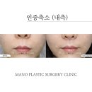 마노성형외과의원 이미지