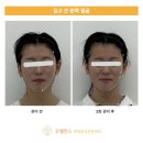 굿밸런스체형분석운동센터 | 굿밸런스 체형분석운동센터 직접 경험한 체형 분석의 효과