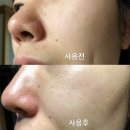 컬러인스킨