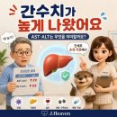 “AST·ALT 간수치가 높으면 간이 안 좋은 걸까요?” 이미지