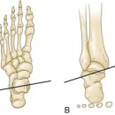 바른길 PT STUDIO 이미지