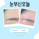눈부신네일 | 전주눈썹 잔흔제거 눈부신오늘 삼천동 문신제거 만족 후기