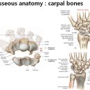 손목 불안정(wrist instability) 이미지