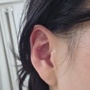 칠보당 | 마포역이혈테라피 플로리아뷰티에 다녀온 후기