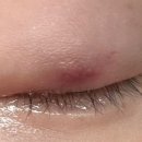 아프니카 이미지