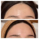 채희 | 대구 침산동 왁싱 채희뷰티, 헤어라인왁싱