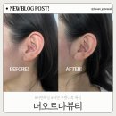 오르다 | 서면왁싱 추천 ｜더오르다뷰티 구렛나루 왁싱 후기