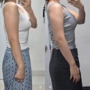 네오웰빙 10분운동샵 | [뺏주사/지방분해주사 + 엠스컬프네오] 강남다이어트 시술후기