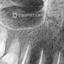 종로크라운 이미지