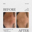 세븐일레븐 광명티타워점 | 광명 피부관리 마벨 뷰티&amp;스킨 피부진단 수분관리 후기