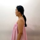 4897 | 송촌동 팔뚝관리 피부관리샵 추천 플레이스킨송촌점