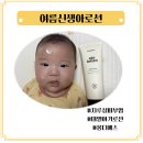 아토제2주유소 | 여름신생아로션 몽디에스 아토로션, 지루성 피부염 아기 후기