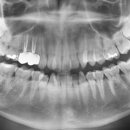 사랑니사랑치과의원 이미지