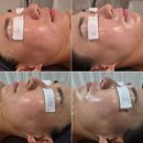 울산 남구 피부관리 잘하는곳 추천 야음동 웰라인 스킨앤바디 퍼스널 A코스