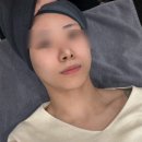 순한의원 | 신사역 티타늄리프팅 받고 온 후기｜제로의원에서 턱선 즉각효과 느낀 날