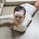 아프지마약국 | 10개월 아기 수족구 증상 수포 전염 잠복기 등원확인서