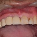 이사랑 치과기공소 이미지