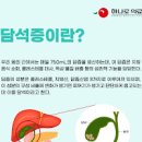 담석증 원인과 치료방법 방치하면 안되는 이유 이미지