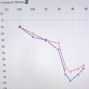 시그니아독일보청기 관악센터 이미지