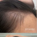 [공지] 세하뷰티 / 소레아 탈모 샴푸 추천!!