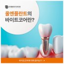 야탑치과 잘하는 곳 임플란트 종류 비용 단계 가격 단단해야 하는 이유
