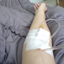 태반주사 효과 기간 부작용 여드름에 효과 본썰!