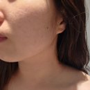 [홍대 피부관리] 작은얼굴 윤곽관리 '탤런트에스테틱 홍대점' 후기