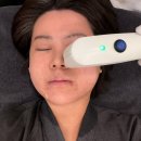 압구정 피부과 온웨이브 온다+소프웨이브 얼굴 라인정리 후기