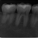 디지레이 이미지