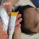 동안 | 청소년여드름화장품 스팟세럼 10일동안 사용후기