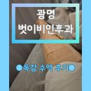 벗이비인후과의원 | A형 독감 증상 벗이비인후과 독감 수액 가격 후기