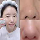 (주)솔루션코 | 악센다 루티너 멀티밤, 사용법 약국 부작용 블랙헤드 후기