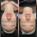 영등포 문래동 _ 문래역 피부관리 작은얼굴 윤곽관리 웨딩관리 후기 [은S스킨바디]
