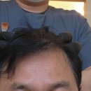 탈모케어존부산 이미지