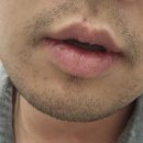 참여성병원 이미지