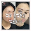 브로 | 강남 눈썹문신 업브로시 솔직 후기
