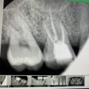 준플란트치과의원 이미지